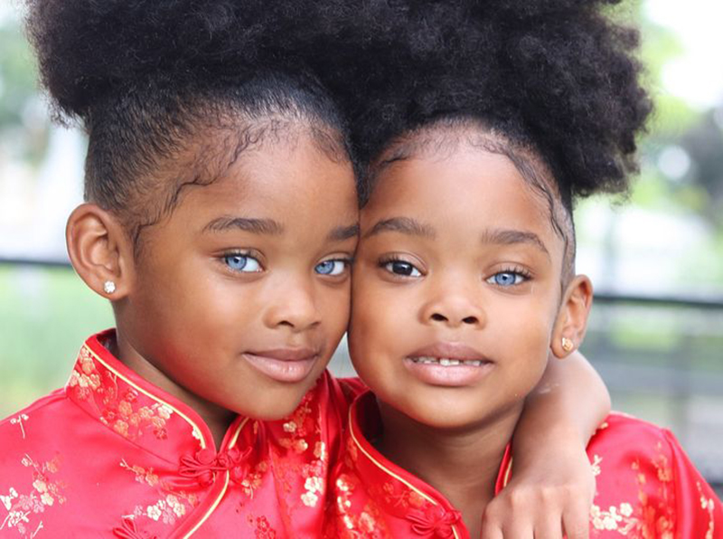 The Truth Behind True Blue Twins Gone Viral | Woman Mgzn