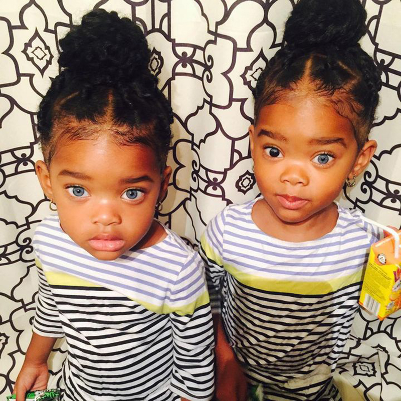 The Truth Behind True Blue Twins Gone Viral | Woman Mgzn